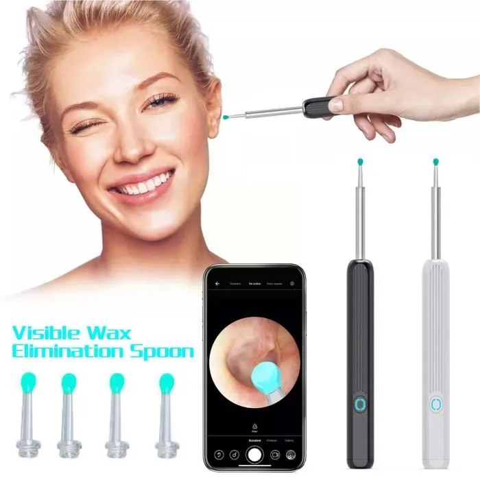 wireless smart otoscope