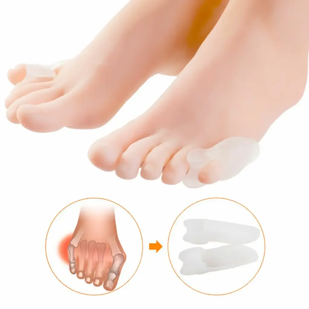 FILS ALL - Little toe hallux valgus 