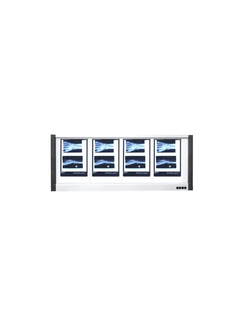 [OP-NL01] Négatoscope Ultra-Fin LED